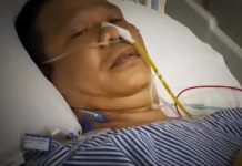 Cerita Mus Setelah Ditikam Saat Debat I