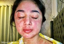 Terpapar Virus Corona, Dewi Persik Ingat Dosa-Dosanya